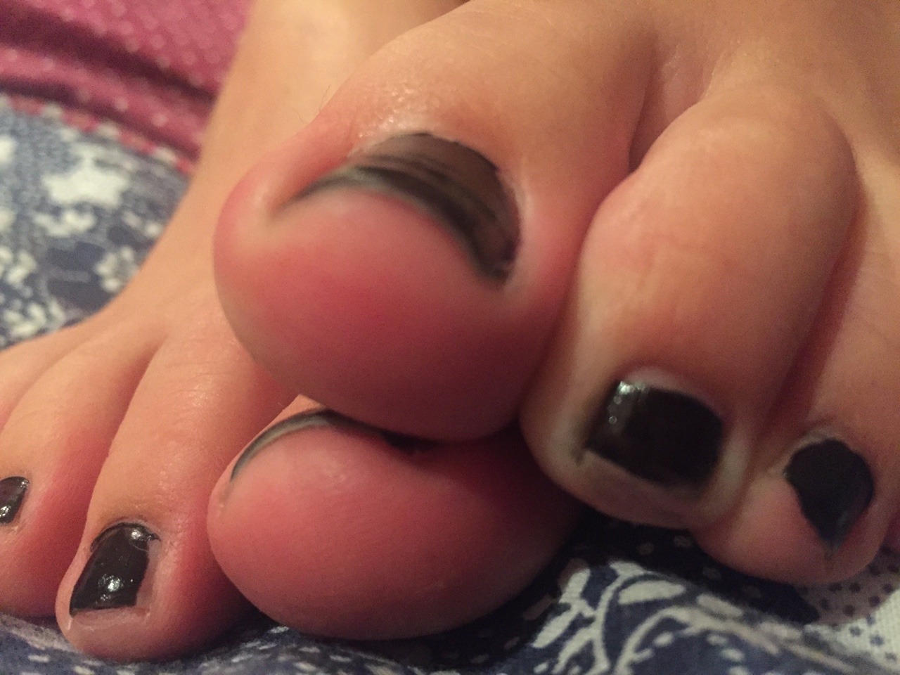 linkasfeet:  Some close up TOES with my bad nail polish work :)