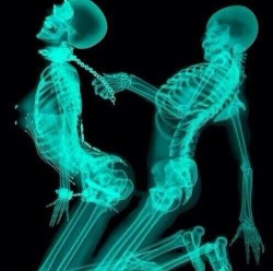 kinkykimmys:  I’m a radiology geek love