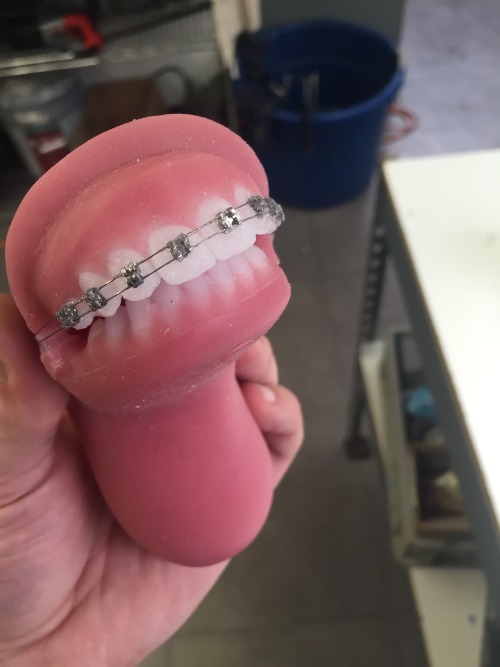 abysscreations:Behind The Scenes! Some braces work we did on a custom mouth for a client!