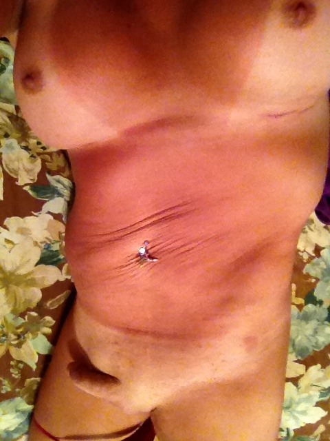 Someone got a little red.  Need help with the lotion?