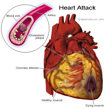 fithome:
“ imgonnariverdance:
“ shadowkat104:
“ kellyjacobsbooks:
“ HOW TO SURVIVE A HEART ATTACK WHEN ALONE
Let’s say it’s 6.15pm and you’re going home (alone of course), after an unusually hard day on the job. You’re really tired, upset and...