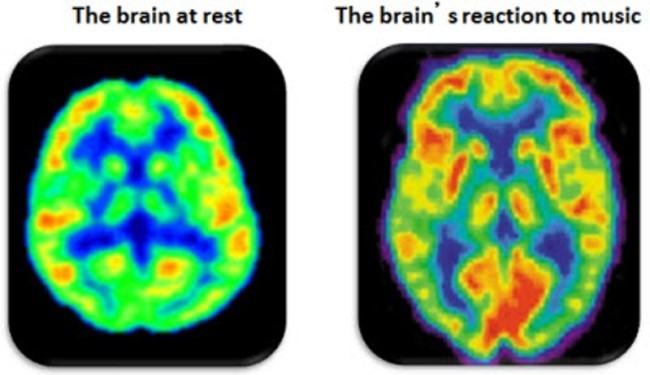 sixpenceee:  Music can: 1) boost your memory 2) improve your spatial reasoning skills