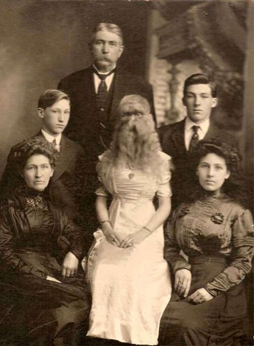 Alice Elizabeth Doherty (1887-1933) Alice E. Doherty was born in 1887 with a rare genetic mutation called “hypertrichosis”, or “werewolf syndrome”, which causes excessive body hair. She was billed as “The Minnesota Woolly