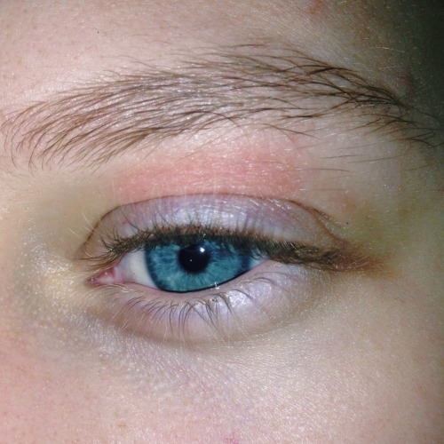 space-treks:my eyes on three separate occasions. the first one is how I have purple eyelids (more so