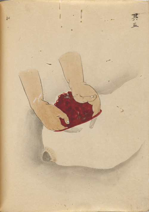 Hanaoka Seishu’s Surgical  Casebook“A Surgical Casebook” is a manuscript of &