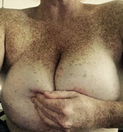 frecklesandhugeboobs:  Freckles Friday, yay I have a day!!!