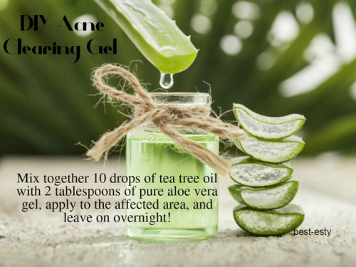 best-esty - Here’s a super simple, all natural acne clearing gel...