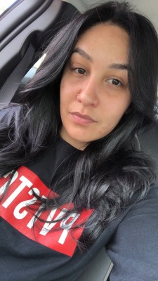 phuckyobitch88:  So this is me without any snap filter. Stye is almost gone and I have pimples. I have my daily skin routine to work and getting my skin better but we all know that takes time. I don’t wear makeup like most woman do now and days. I may