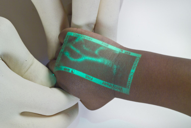 medicalstate:VeinViewer by Christie Medical Holdings. An infrared device that detects