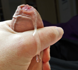 yesforeskin:Dripping Yummy