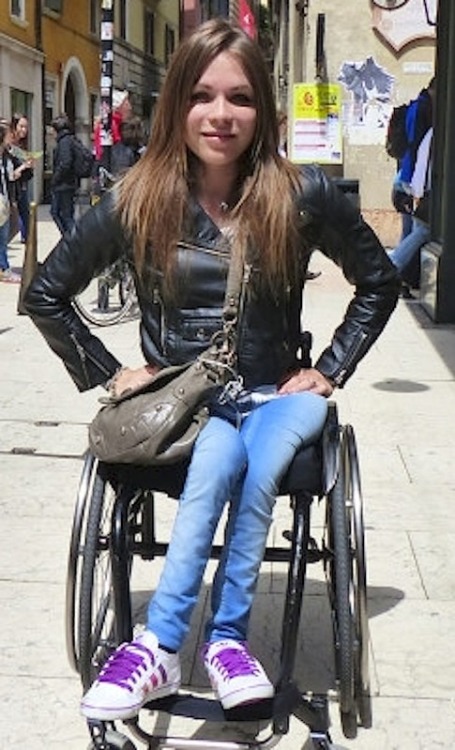 para hottie with extreme leg atrophy