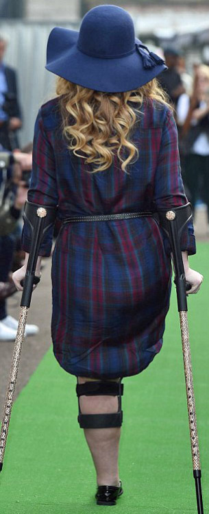 phelddagrif: Lost her leg in the Alton Towers crash.  She made her catwalk debut at a Models of Dive