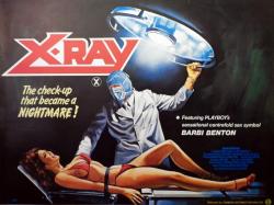 mastersofthe80s:  X-Ray (aka ‘Hospital