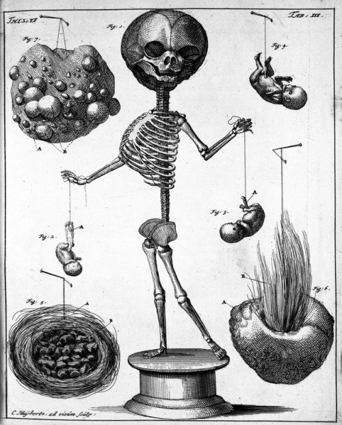 Cornelis Huyberts (1669-1712), “Thesaurus Anatomicus” by Frederik Ruysch, 1705Source