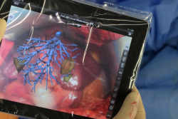 recipeforawesome:   (via Augmented Reality App Guides Surgeons During Tumor Removal - PSFK) Tablets and smartphones have recently found a wide range of uses in the healthcare industry, from building image databases for doctors to helping patients better