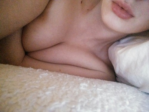 dullwhitegirl:  I have beauty marks everywhere 