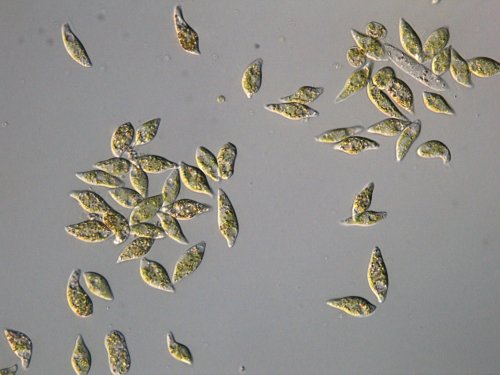 Super algaeThe image above shows Euglena gracilis, a single-cell algae lurking in garden ponds.It mi