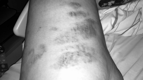 mamabearisabrat: Love my marks, hope they stay longer than two days this time.