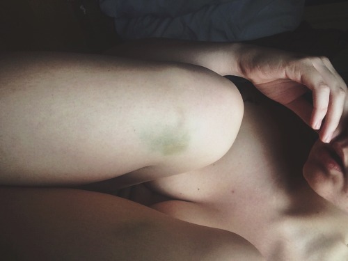 illbeg00d:  Bruise like a 🍑