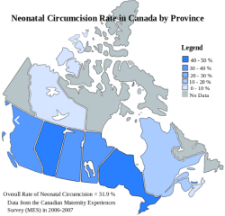 pro-circoncision:  Le taux de circoncision néonatale au Canada est de 31,9% ! Le Québec reste cependant en dessous de la barre des 20%…