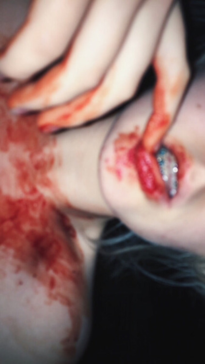 deranged-haematophiliac:anon submission be featured on my blog - send me your bloody pics