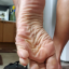 ripplesorwrinkles