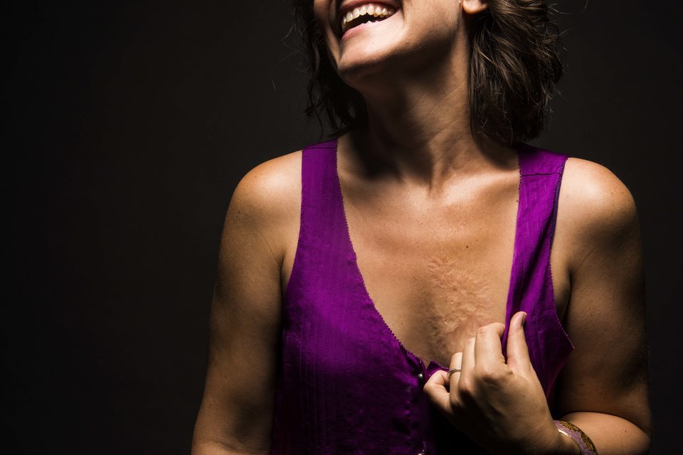 huffingtonpost:  24 Women Bare Their Scars To Reveal The Beauty In Imperfections“It’s