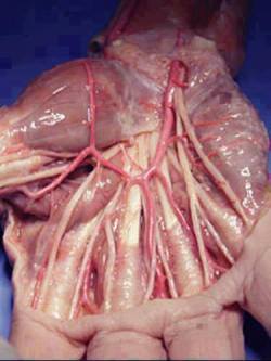 look-past-the-mirror-and-gasp:  This is a picture of a normal human hand with the skin ripped off.   We’re complex, yet so fragile   A cut to your neck and you could die.  A certain amount of blood lost and you die.  Not getting enough sugar into