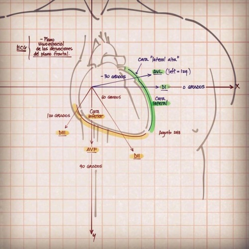 Walls and leads: If u dnt get a visual spatial look at the ecg leads, its harder to understand which
