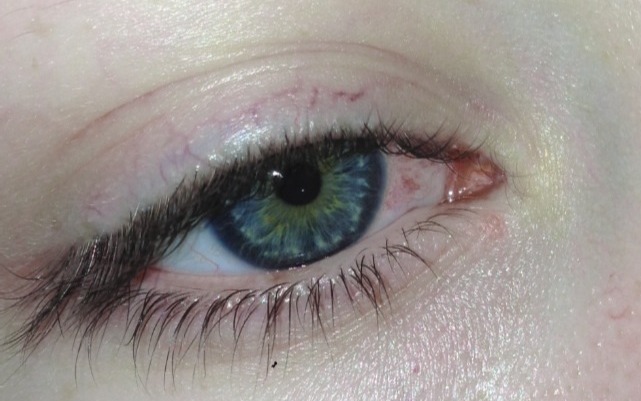 gargle blood swallow teeth — My eyes are tired, my skin is tired, my legs  are...