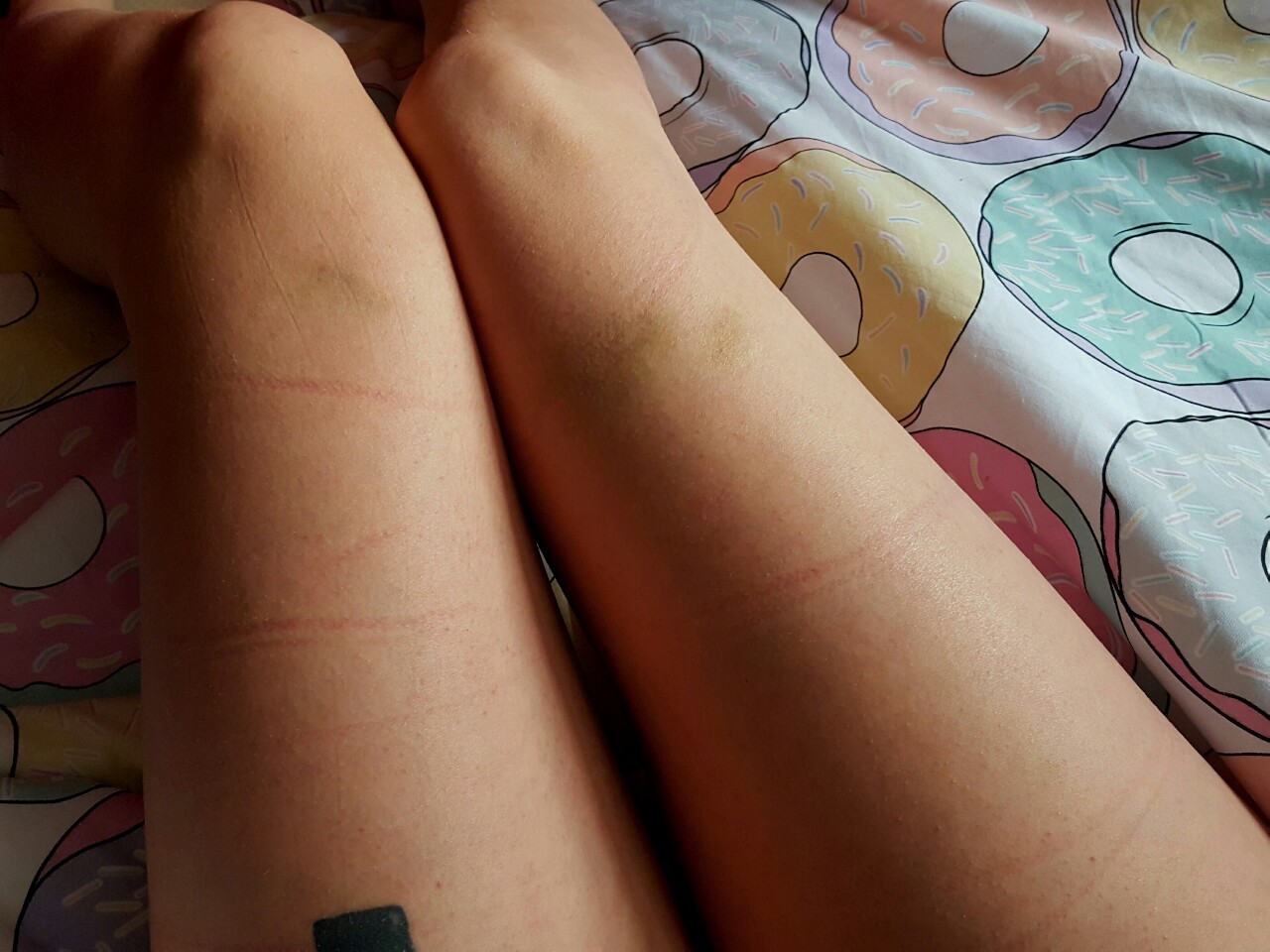 kitkatl0ad:  Ropemarks &amp; chill