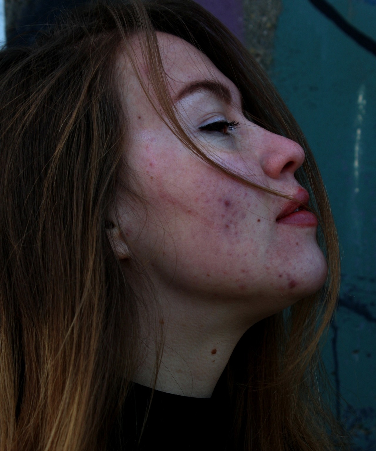 hiraeeeth:some photos of my photoproject which is called “Redefining beauty ”