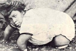 &ldquo;Alzoria, the Turtle Girl&rdquo; was born in 1912, the only child in a family of nine afflicted with her peculiar condition. She made a career for herself exhibiting at Coney Island from the 1930s-50s, under a variety of unflattering names including