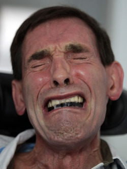 Locked-in syndome sufferer Tony Nicklinson shows emotion as he is told he has lost his High Court battle for the legal right to end his life with a doctor’s help.