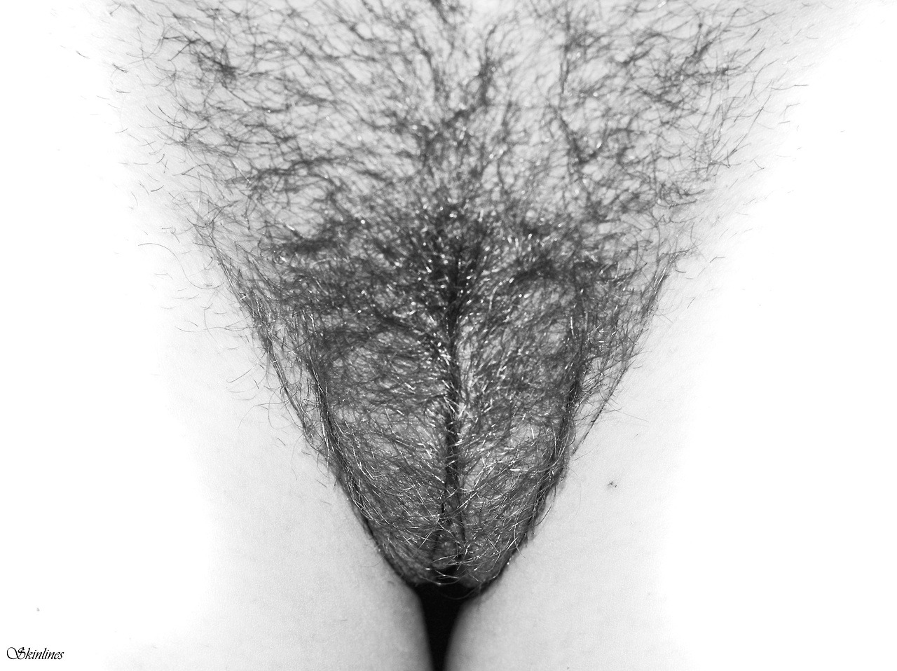skinlines:  © Skinlines 2017