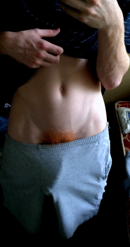 ginger-tidings:Firecrotch rules!