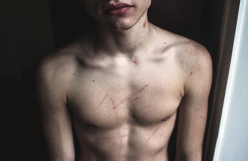 coltre: I took this picture today; the dots, the marks on the skin. The bruises, the scratches. It m