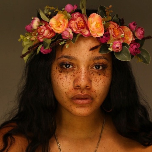 sissyhiyah: blackkginger: Me MelMikel trokonv I love seeing models with freckles. It makes me feel l