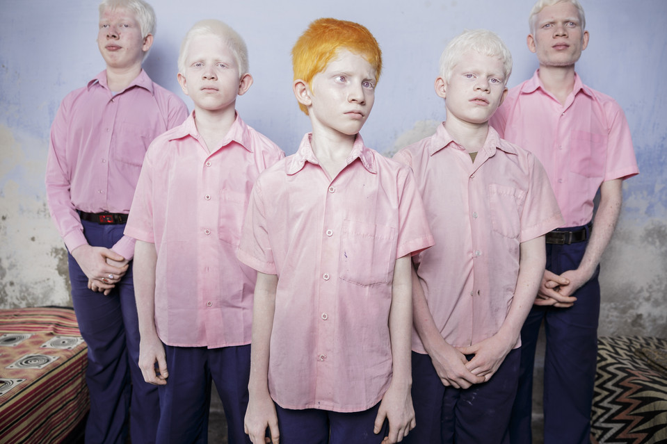 untrustyou:  Brent Stirton A group of blind albino boys posed for a portrait in their