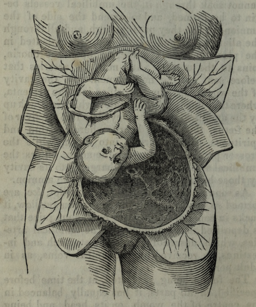 In utero. The midwife’s guide. 1845.Internet Archive