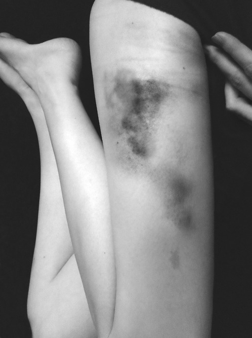 morphine-and-cigarettes:  sad black and white blog, I follow back similar