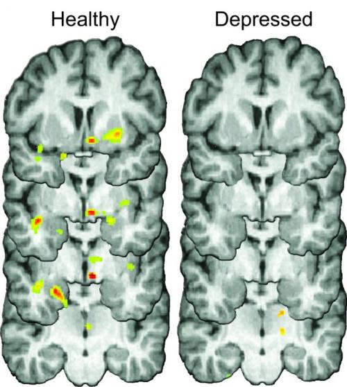 Sex neuromorphogenesis:  Shake it off? Not so pictures