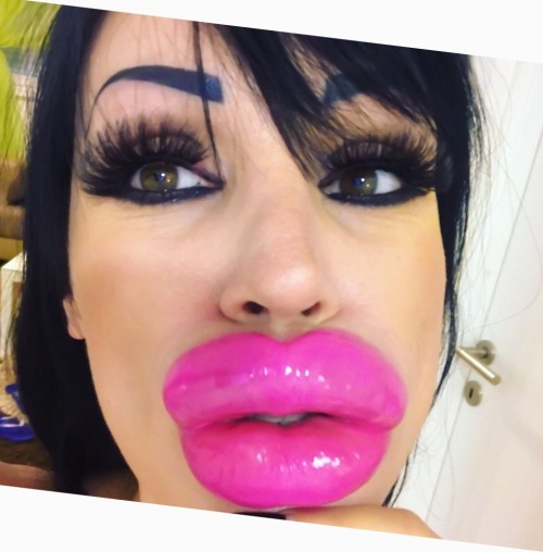 plasticpornslut:philuranus:modern-femininity:Lip FillerLip filler is a lot cheaper than fake tits.Li