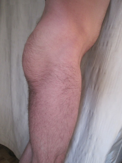 Beardburnme