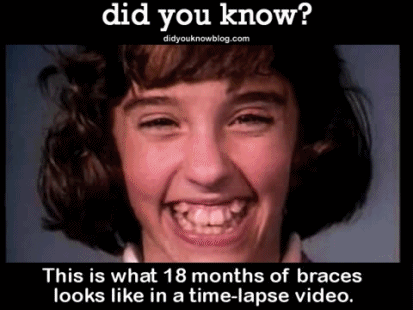 did-you-kno:  Vintage orthodontery at its finest.Source