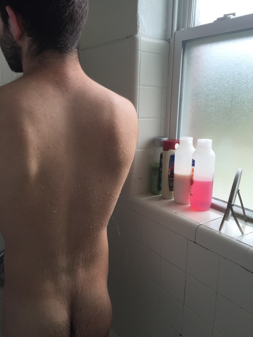 meowboyy:  My sunburn healed and I can finally take hot showers