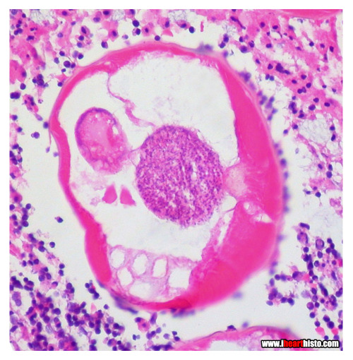 Histology Look-a-like #184