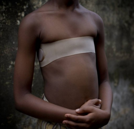 newpharaohofold:  trippyspice:  agayhurricane:  funkychunkyfuckinmunkey:  sixpenceee:  swiggity-swegan:  sixpenceee:  Breast ironing is the pounding and massaging of a pubescent girl’s breasts, using hard or heated objects, to try to make them stop