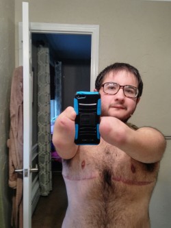 radicalspacecub:  I am trans. I am disabled. I am fat. My scars are a part of me. I am visible.