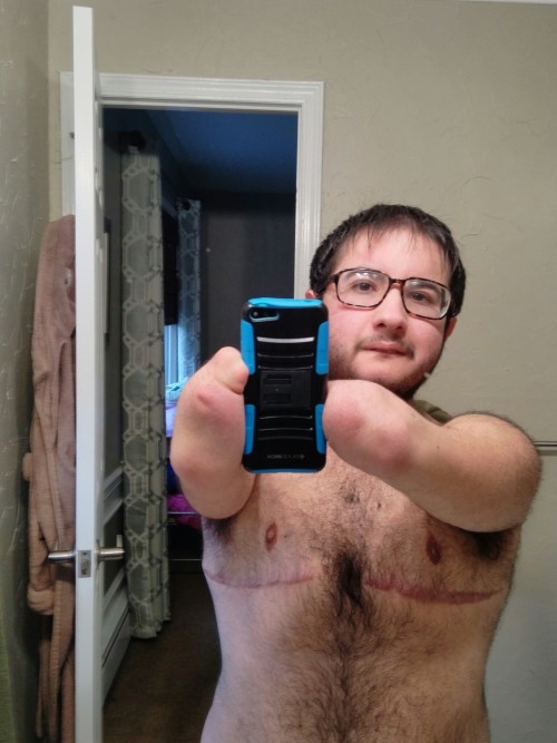 radicalspacecub:I am trans. I am disabled. I am fat. My scars are a part of me. I am visible.